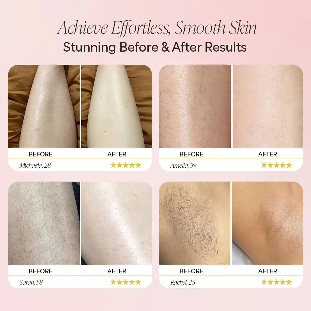 ماكينة تشذيب الشعر Dermave™ 2.0 - TENDI